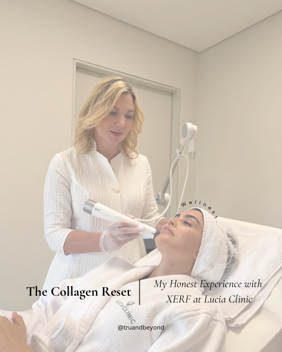 Collagen Reset XERF: The Treatment That Made Me Rethink Non-Surgical Skin Tightening